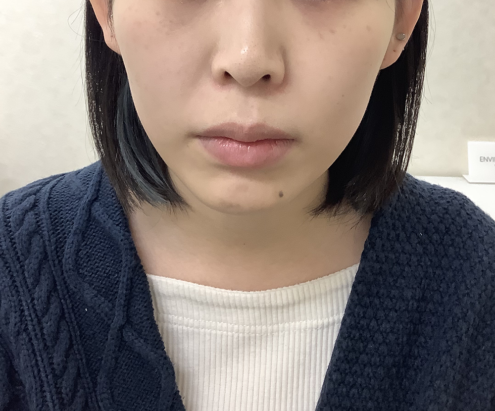 症例写真