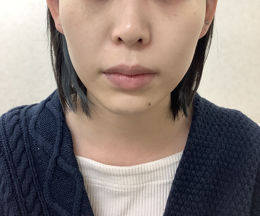 症例写真