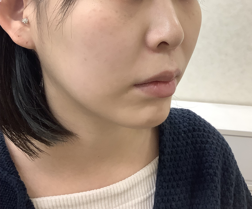 症例写真