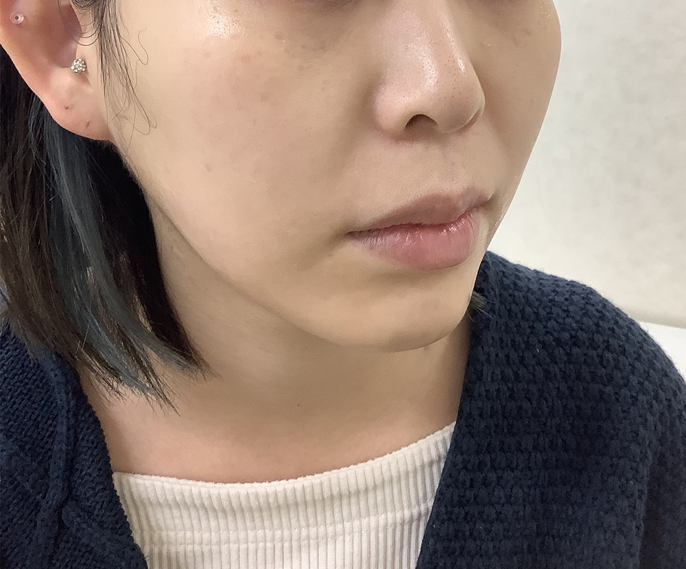 症例写真