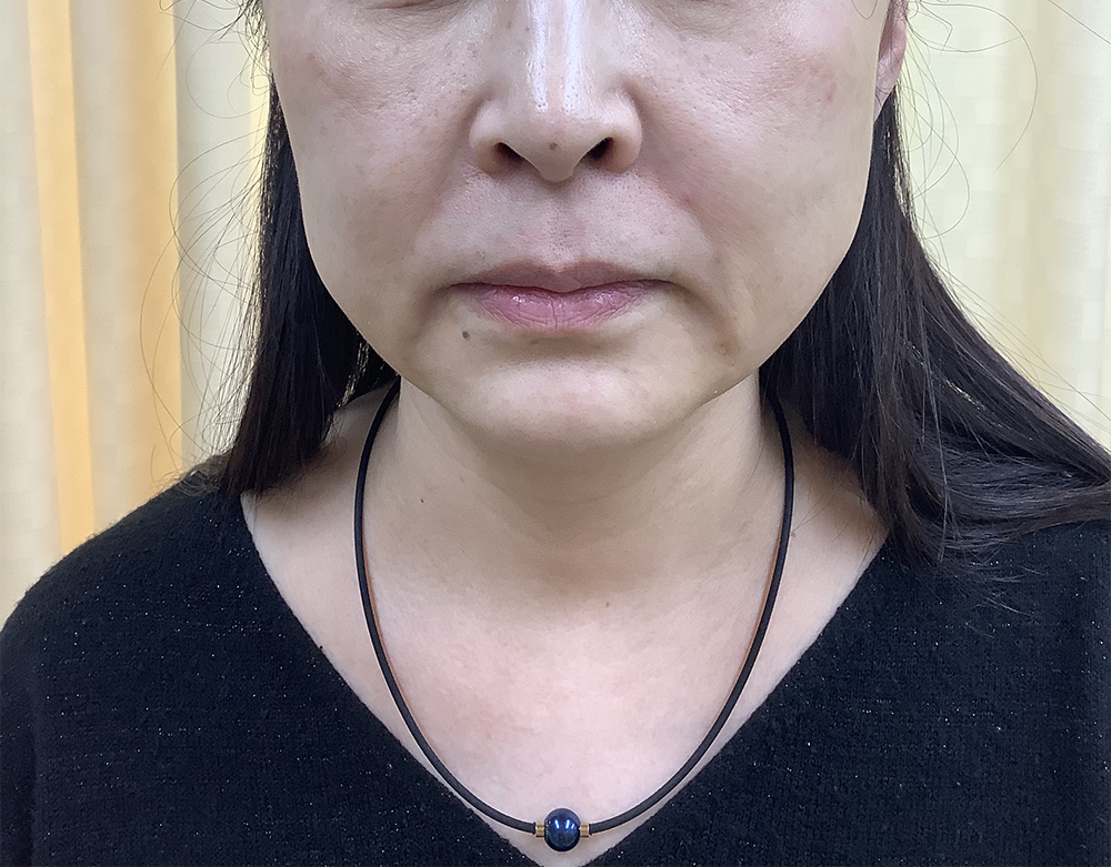 症例写真